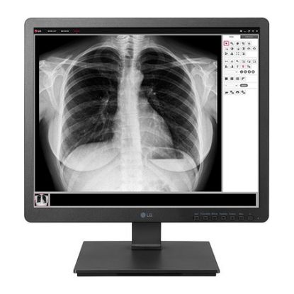 Imagem de Monitor LG 19" Clinical 19HK312C IPS LED 5:4 (5ms)
