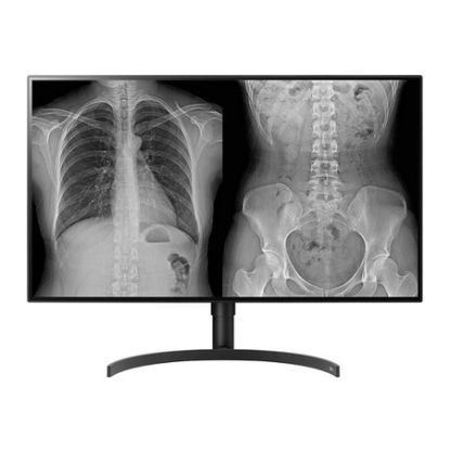 Imagem de Monitor LG 31.5" Clinical 32HL512D-B IPS FHD 16:9 60Hz HDR10 (5ms)